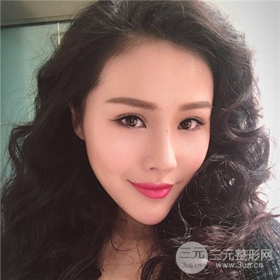 溫州友好醫(yī)院羅吉華眼部整形失敗修復(fù)真人案例分享