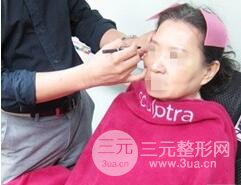 自從打了膠原蛋白除皺以后，都說我年輕多了