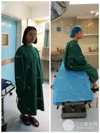 武漢卓美吳秀英雙眼皮+開眼角一個(gè)月恢復(fù)對(duì)比照片分享~