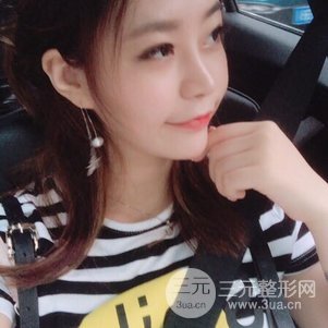 上海九院鼻部韓式生科芭比線條修復