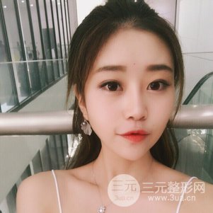上海九院鼻部韓式生科芭比線條修復