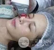 我做了光子嫩膚幾天起而且價(jià)格便宜前后對(duì)比照片案例