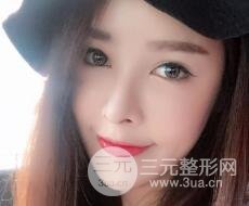 大腿抽脂做臉部脂肪填充 包括太陽(yáng)穴和額頭價(jià)格果分享