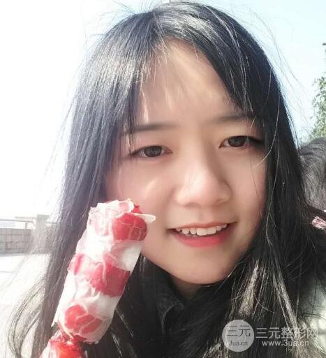 怎樣減掉雙下巴？雙下巴吸脂后個(gè)人經(jīng)歷 價(jià)格略貴但果好