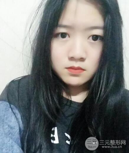 怎樣減掉雙下巴？雙下巴吸脂后個(gè)人經(jīng)歷 價(jià)格略貴但果好