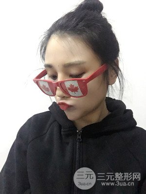 珠海萊茵門診部馬中衛(wèi)隆鼻整形案例分享，并附上前后對比照片~