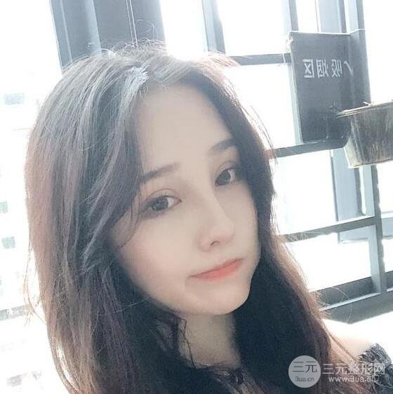 蘇州芘麗芙華美甘月圓自體脂肪填充全臉恢復(fù)記錄