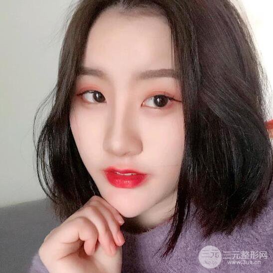 膨體隆鼻三十天恢復(fù)記錄，術(shù)前術(shù)后對比圖片曝光