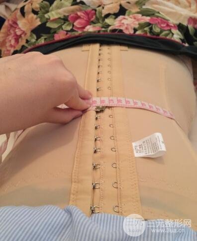 腹部抽脂價格和恢復(fù)案例