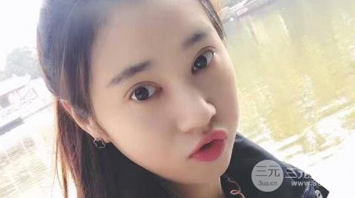 切開雙眼皮+開內(nèi)眼角案例