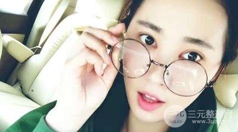 切開雙眼皮+開內(nèi)眼角案例