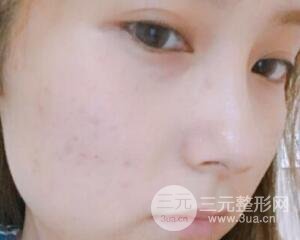 注射水光補(bǔ)水價(jià)格和案例圖片