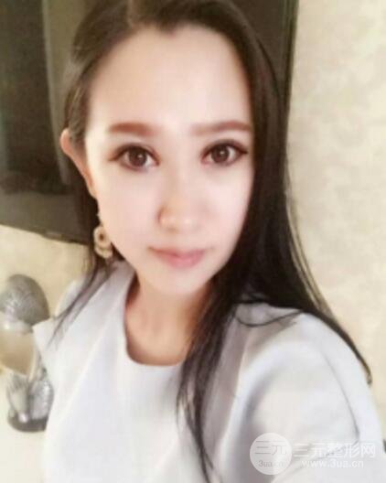 雙眼皮修復(fù)術(shù)價錢和案例圖