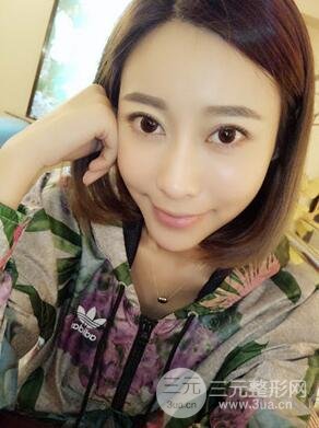 埋埋蛋白線.提升真實案例分享，珠海萊茵門診部馬中衛(wèi)醫(yī)生做的