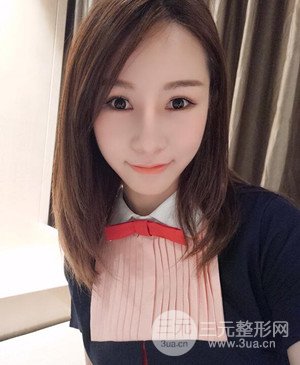 武漢美都張召醫(yī)生給我做的隆鼻整形手術(shù)，給大家分享一下前后照片