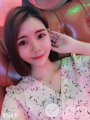 自體脂肪填充全臉真實(shí)案例——濟(jì)南愛(ài)容張慶國(guó)醫(yī)生做的