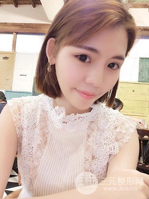 自體脂肪填充全臉真實(shí)案例——濟(jì)南愛(ài)容張慶國(guó)醫(yī)生做的