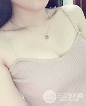 濟(jì)南海峽趙廣生自體脂肪隆胸真實(shí)案例附上前后對比圖