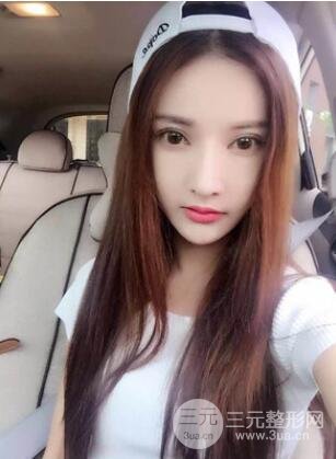 我的埋埋蛋白線.提升日記：真實案例——濰坊華美童艷梅醫(yī)生做的