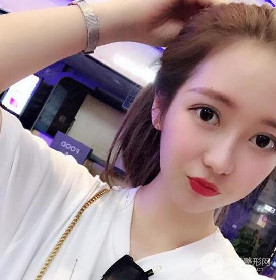 長(zhǎng)得太著急是怎樣一種體驗(yàn)？妹子血淚分享自體脂肪填充詳細(xì)部年輕化經(jīng)驗(yàn)