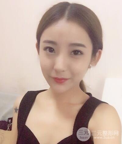 注射玻尿酸注射除皺緊致肌膚前后對(duì)比圖案例