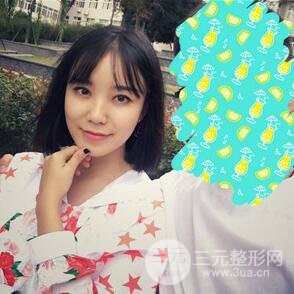 雙眼皮+開內(nèi)眼角手術(shù)前后對比圖片，真實案例