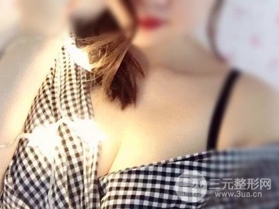 宜昌中愛張宜彬醫(yī)生給我做的假體隆胸手術(shù)，分享一下前后照片