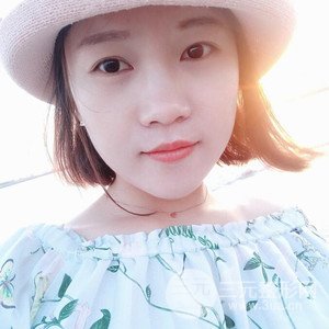 注射水光補水案例——襄陽維多利亞聶立敏醫(yī)生做的