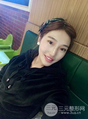 激光脫毛前后照片分享，真實案例~