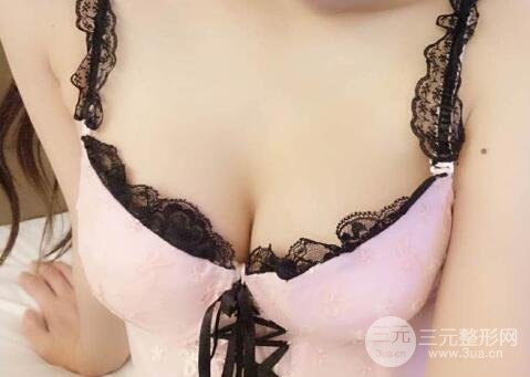 本人自體抽脂隆胸手術(shù)果很好價格案例