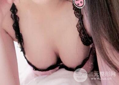 本人自體抽脂隆胸手術(shù)果很好價格案例