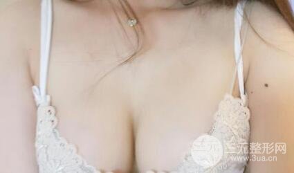 本人自體抽脂隆胸手術(shù)果很好價格案例