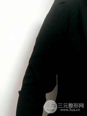 武漢天申朱天申醫(yī)生做的水動(dòng)力吸脂瘦手臂，真實(shí)案例并附上前后對(duì)比圖