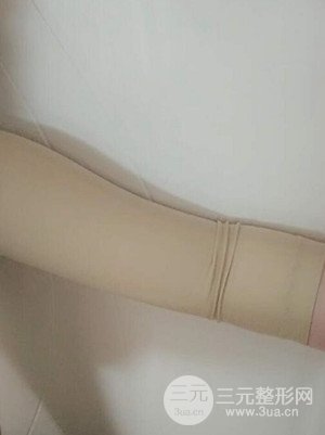 武漢天申朱天申醫(yī)生做的水動(dòng)力吸脂瘦手臂，真實(shí)案例并附上前后對(duì)比圖