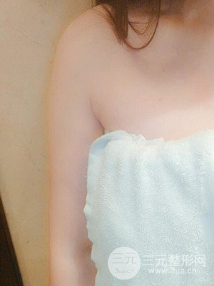 武漢天申朱天申醫(yī)生做的水動(dòng)力吸脂瘦手臂，真實(shí)案例并附上前后對(duì)比圖