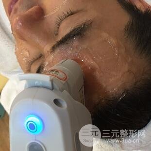 男士高強(qiáng)度聚焦超聲面b提升微整形真實(shí)案例