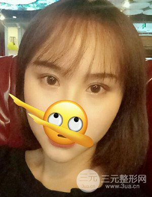 武漢天申胡麗醫(yī)生發(fā)際線種植真實(shí)案例，并附上前后對比圖片