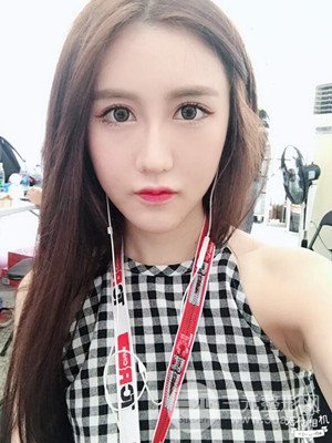 武漢一美汪國民醫(yī)生做的面部吸脂【案例】，分享一下前后對比圖片