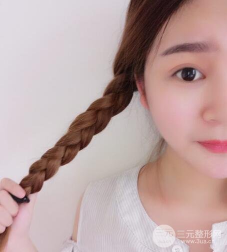 全切開雙眼皮價格和恢復(fù)過程對比圖片