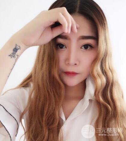 全切開雙眼皮價格和恢復(fù)過程對比圖片