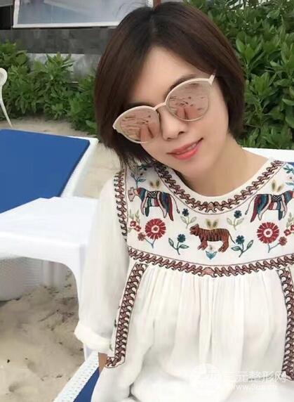 去做了埋線面b提拉術(shù)果很是不錯(cuò)