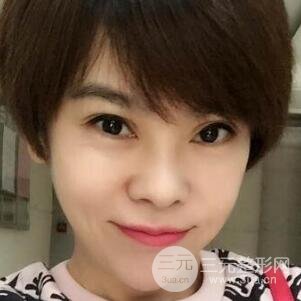 去做了埋線(xiàn)面b提拉術(shù)果很是不錯(cuò)