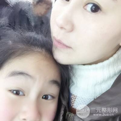 武漢美侖陳遠(yuǎn)海自體脂肪填充全臉案例，附上前后對(duì)比圖片