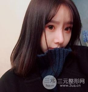 武漢希思特楊權(quán)明假體隆鼻案例日記真實記錄分享