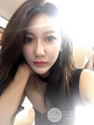 上海原辰自體脂肪填充案例，附上恢復(fù)過程以及對比圖片