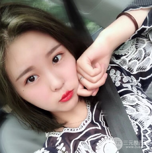 面部光纖溶脂三個月恢復記錄，妹子終于擺脫大臉盤子辣