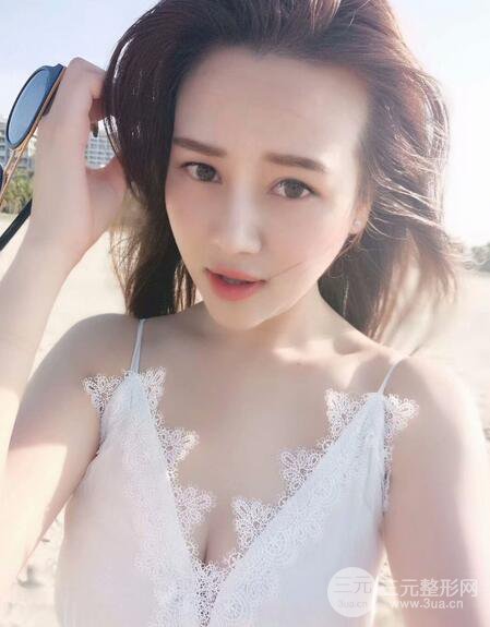 【高強度聚焦超聲面b提升術(shù)后照片】原來我的青春并沒有走遠~