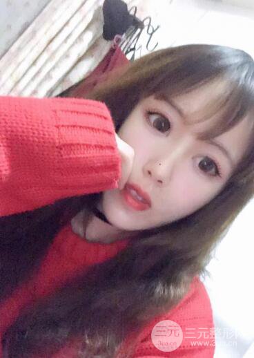 自體脂肪填充全臉基本換臉，改臉型不只是磨骨才能做到！