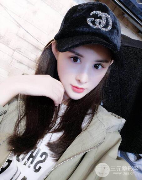 【隆鼻失敗修復(fù)】自體脂肪隆鼻隆鼻整形拯救之后可以隨意揉捏！