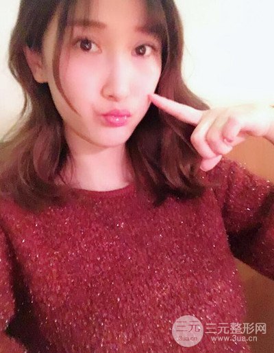 蘇州美貝爾假體隆胸案例，對比圖恢復(fù)過程分享~